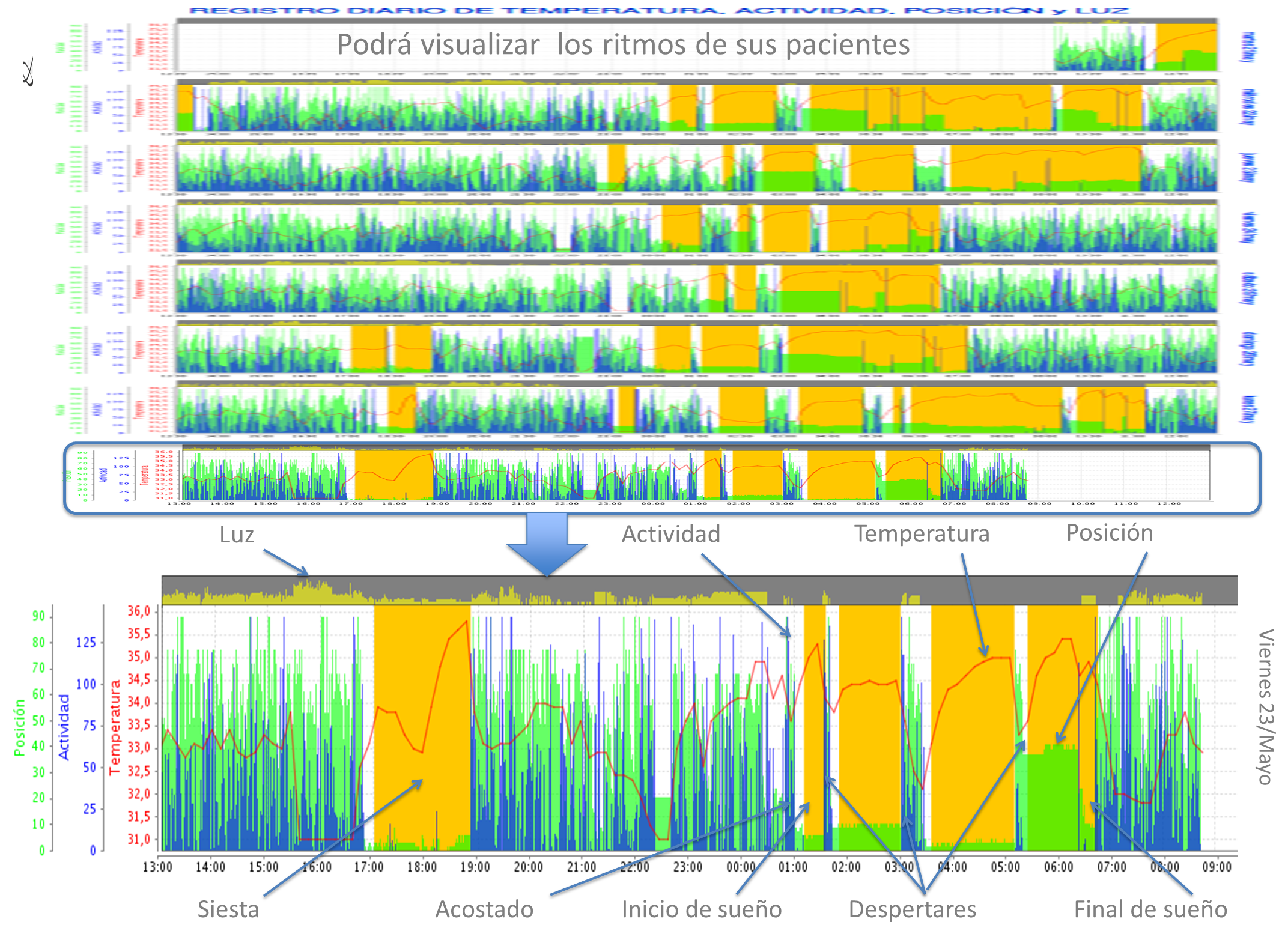 Visualización